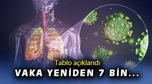 Haziran 1, 2021 3 min read faruk. P R Nviiohszfm