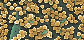 We did not find results for: Phagentherapie Startschuss Fur Eine Koordinierte Forschung In Deutschland