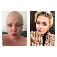 Žena si myslela, že má COVID-19, pravda bola oveľa horšia: Jej posledné  želanie vám zlomí srdce