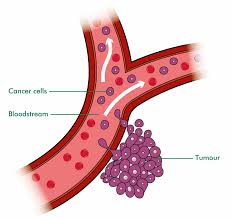 It doesn't move around, fixed to the tissue. Secondary Liver Cancer Macmillan Cancer Support