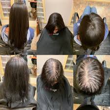 To dream of the hair loss symbolizes impotence, weakness or feelings and concerns for your physical state. A Free Consultation Can Fulfill All Your Dreams Transform Yourself To Reflect A More Youthful Attractive You 2019 Is The Y Hair Loss Specialist Hair Beauty