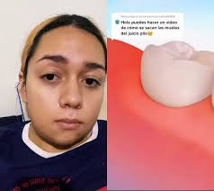 Risas garantizadas con mi cachetes de ardilla y mis muelas