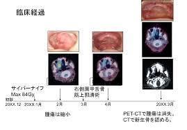 「サイバーナイフ」の画像検索結果