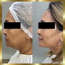 Dra. Erika Arrais Peter