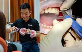Tag dental, klinik gigi murah di johor bahru, terdapat doktor gigi & perkhidmatan scaling gigi, tampal gigi, rawatan akar gigi, pendakap gigi. Tampal Gigi In English Bagaimana Kalau Gigi Anda Sumpik Atau Pecah Sebelah Dan Mengakibatkan Gigi Kelihatan Berlubang Dari Isteri Saya Membuat Rawatan Tampal Gigi Di Klinik Pergigian Kerajaan Perai