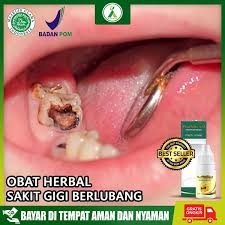 We did not find results for: Jual Produk Obat Sakit Gigi Gusi Bengkak Termurah Dan Terlengkap Agustus 2021 Bukalapak