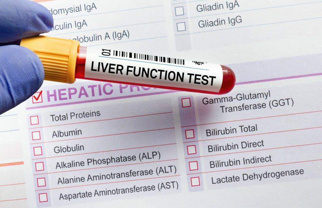 Liver Function Test (LFT) product image