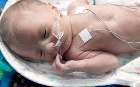 Get safety tips, and learn how to prepare for baby's bath, how often to bathe baby, and how to clean the infant. Properly Caring For Your Baby After A Circumcision