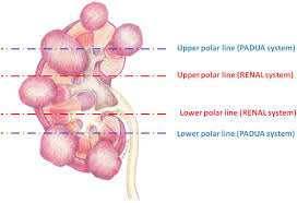 • (a) diagram demonstrating the scoring for the p.a.d.u.a. Introduction To Small Renal Tumours And Prognostic Indicators Sciencedirect