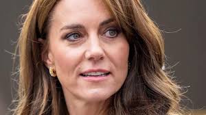 Kate Middleton se ha sometido a cirugía estética? ¿Está permitido en la  familia real?