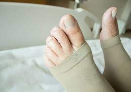 Compression Socks Archives The Vein Center Of Maryland