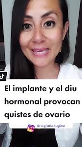 ¿El implante y el DIU hormonal provocan quistes de ovario?