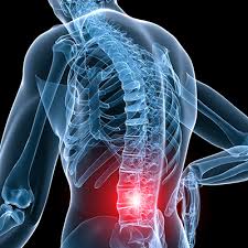 Image result for Spinal Trauma