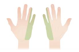 We had a small gig that night and the next morning, the pain was twice as intense. Ulnar Nerve Entrapment At The Elbow Cubital Tunnel Syndrome Orthoinfo Aaos