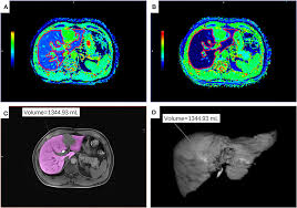 Image result for Usm 22159