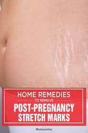 Bio Oil Pregnancy Stretch Marks Before And After Birth Pin On Skin Treatments