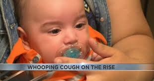 Whooping Cough