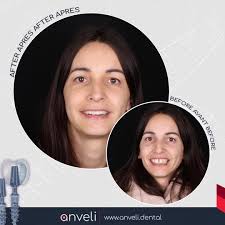 Anveli Dental