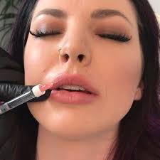 Je vous parle des limp. Injections Aux Levres 8 Choses A Savoir Avant De Se Faire Grossir Les Levres