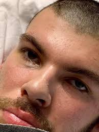 Does a twitching in the affected arm mean it's going to start working again?