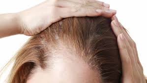 A research study at suny university showed decades ago that aspartame use during pregnancy lowered the iq of the fetus by an. 4 Foods That Are Making Your Hair Thin According To A Dermatologist Shefinds