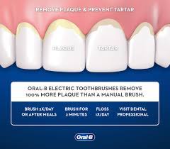 Let the peroxide work its magic for 12 hours. How To Get Rid Of Plaque And Remove Tartar Buildup Oral B