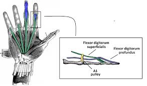 The fdp and fpl tendons are found in the deepest level of the carpal tunnel. The Flexor Pulley System Of The Hand Annular Cruciate Oblique Teachmeanatomy