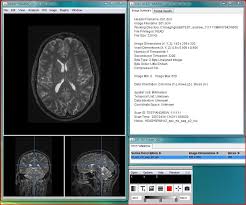 It is software that lets users access the data in an easy manner. 5 Dicom Viewers For Any Practice