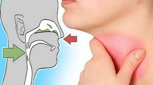 علاج البلغم ويكي مصر