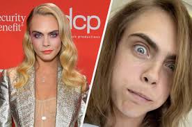 For fans of cara delevingne! Cara Delevingne Documented Her Wisdom Teeth Removal
