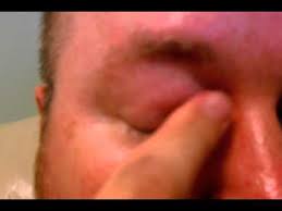 My Eye Makes Squeaky Noises Turn Up Volume Youtube