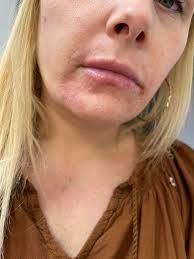 Only anonymous because this group is public and I don't want this post  popping up