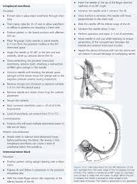 Image result for Intrapleural Anesthesia