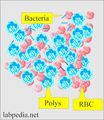 Epithelial Cells In Urine: Normal Range, Causes, How To Reduce