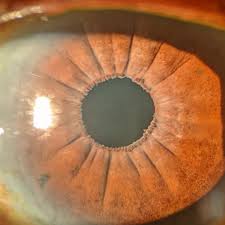 Image result for Pseudoconyza