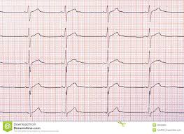 heart rhythm chart stock image image of medical cardiology