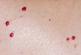 And in colour from bright red to darker tones. Skin Problems Weird Conditions Associated With Aging