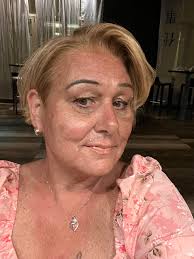 Today is my 1 year Anniversary. Type B dissection, medically managed. I'm  so grateful… I'm so greatful to be alive by the Grace of God & the  doctors/specialists who have helped me