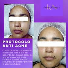 Karen Navarro Cosmiatría, Cosmetología y Estética