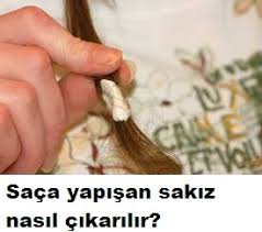 Saca Yapisan Sakizi Bu Yontem Ile Cikarin Bayanlar Kahvesi