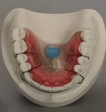So retainers really aren't so bad! The Smart Retainer Environmental Microsensor Is Comprised Of A Download Scientific Diagram