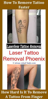 Getting a tattoo removed can be extremely painful ! Hypopigmentation After Tattoo Removal Tattoo Removal Clinic New Laser Tattoo Removal Technology How Much Tattoo Removal Cost Laser Tattoo Tattoo Removal Cream