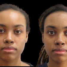 ABOUT FACE AESTHETIC CENTERS