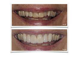 Pin On Dental