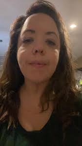 Where does radio frequency skin tightening ?