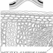 Image result for Antopetitia abyssinica