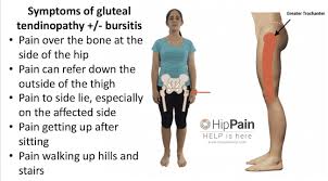 There are many possible causes of hip pain. Gluteal Tendinopathy Symptoms Diagnosis Gtps Trochanteric Bursitis Do I Have This