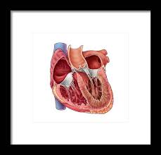 Image result for Restrictive Cardiomyopathy