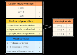 Image result for Breast Cancer Staging