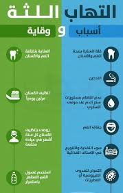التهاب اللثة أسباب و وقاية مجمع عيادات بيرل اسنان جلدية ليزر الرياض الازدهار 0112 Health And Wellness Center Dental Hygiene Humor Dentist Clinic